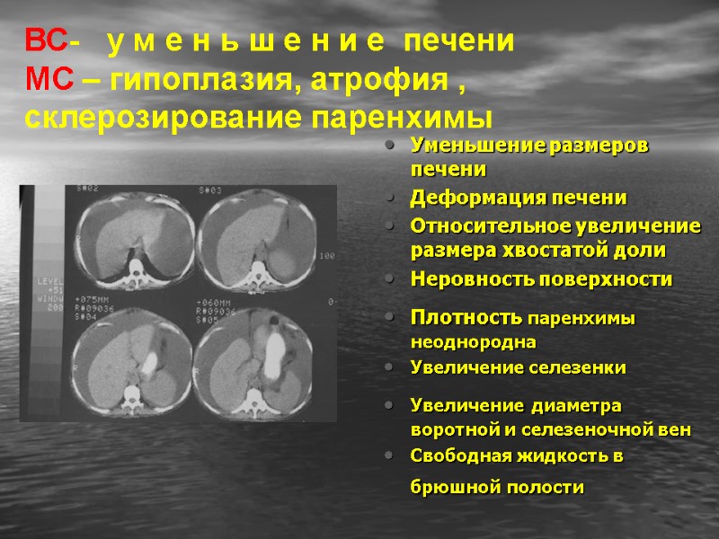 ВС-   у м е н ь ш е н и е 